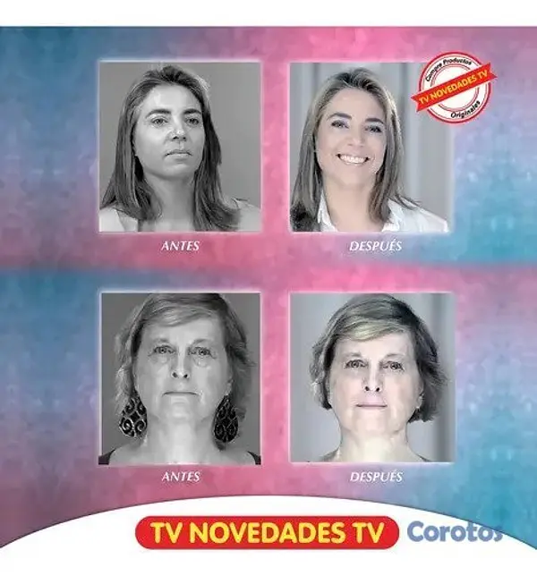 salud y belleza - Sistema de dermoabrasión Diamant Skin 2