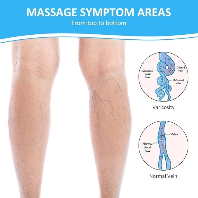 salud y belleza - CREMA PARA VENAS VARICOSAS	 6