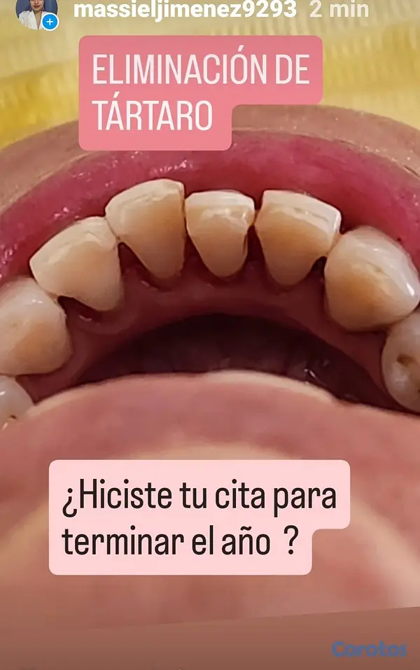 servicios profesionales - OFERTA BUCAL PARA MAMÁ  4