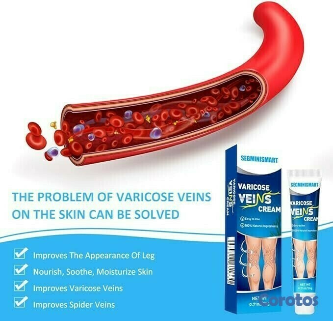 salud y belleza - CREMA PARA VENAS VARICOSAS	 4