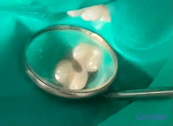 servicios profesionales - PROCEDIMIENTOS DENTALES 2