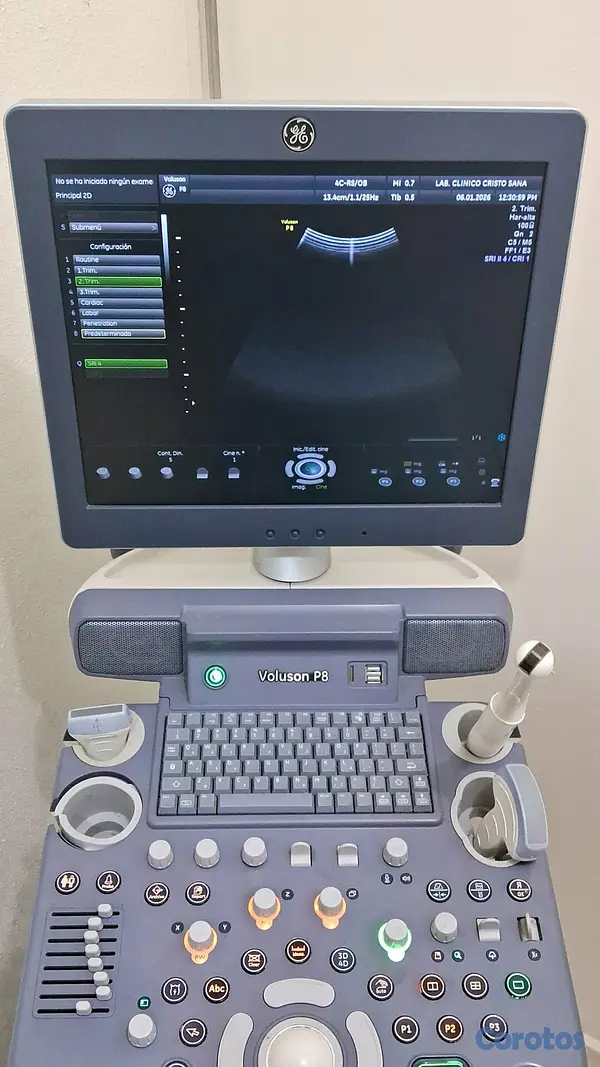 equipos profesionales - 🔬 Se vende Sonógrafo / Ultrasonido 12