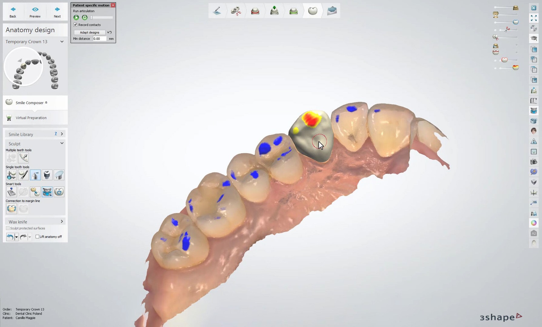 equipos profesionales - 3Shape Dental System Full Version Cracked Bibliotecas incluidas.