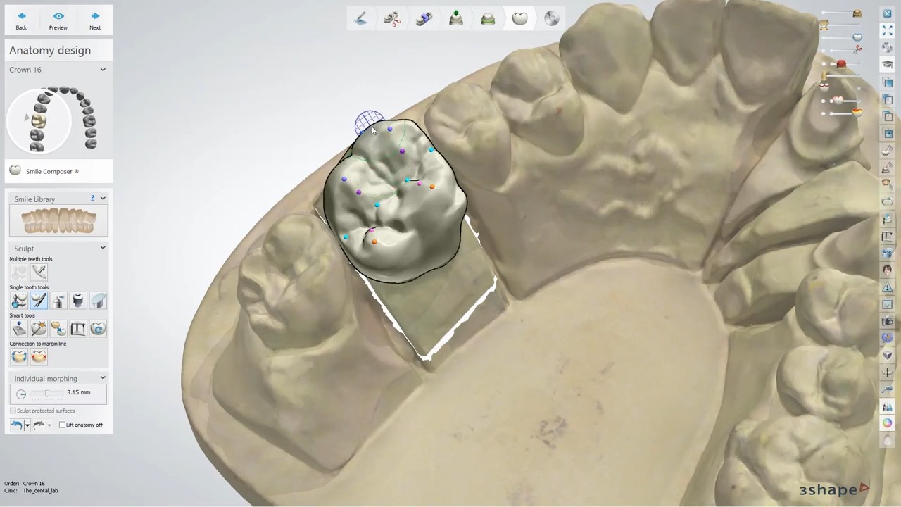 equipos profesionales - 3Shape Dental System Full Version Cracked Bibliotecas incluidas. 5