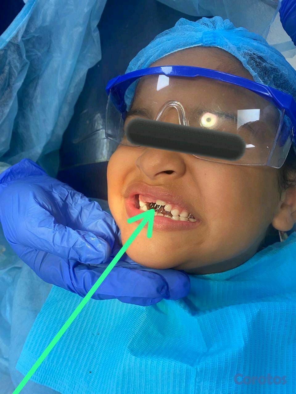 equipos profesionales - limpieza y caries  para niños (Ver imágenes y leer la descripción)
 9