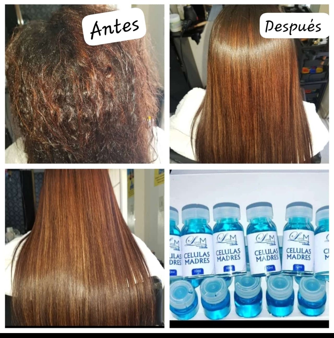 salud y belleza - Ampollas capilares de células madres  1